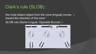 Using Slob Rule Radiograph Endodontic radiography.................. | PPTX