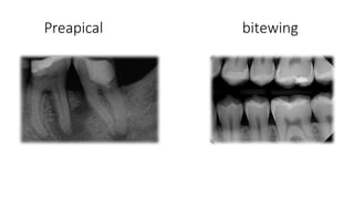 Bitewing Radiography Slide endodontic radiography.pptxSampleMAXILOFACIAL | PPTX