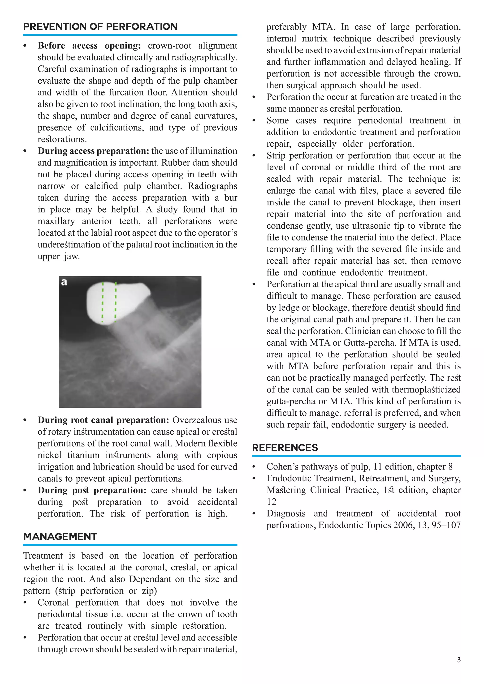 PREVENTION OF PERFORATION
•	 Before access opening: crown-root alignment
should be evaluated clinically and radiographically.
Careful examination of radiographs is important to
evaluate the shape and depth of the pulp chamber
and width of the furcation floor. Attention should
also be given to root inclination, the long tooth axis,
the shape, number and degree of canal curvatures,
presence of calcifications, and type of previous
restorations.
•	 During access preparation: the use of illumination
and magnification is important. Rubber dam should
not be placed during access opening in teeth with
narrow or calcified pulp chamber. Radiographs
taken during the access preparation with a bur
in place may be helpful. A study found that in
maxillary anterior teeth, all perforations were
located at the labial root aspect due to the operator’s
underestimation of the palatal root inclination in the
upper jaw.
•	 During root canal preparation: Overzealous use
of rotary instrumentation can cause apical or crestal
perforations of the root canal wall. Modern flexible
nickel titanium instruments along with copious
irrigation and lubrication should be used for curved
canals to prevent apical perforations.
•	 During post preparation: care should be taken
during post preparation to avoid accidental
perforation. The risk of perforation is high.
MANAGEMENT
Treatment is based on the location of perforation
whether it is located at the coronal, crestal, or apical
region the root. And also Dependant on the size and
pattern (strip perforation or zip)
•	 Coronal perforation that does not involve the
periodontal tissue i.e. occur at the crown of tooth
are treated routinely with simple restoration.
•	 Perforation that occur at crestal level and accessible
through crown should be sealed with repair material,
preferably MTA. In case of large perforation,
internal matrix technique described previously
should be used to avoid extrusion of repair material
and further inflammation and delayed healing. If
perforation is not accessible through the crown,
then surgical approach should be used.
•	 Perforation the occur at furcation are treated in the
same manner as crestal perforation.
•	 Some cases require periodontal treatment in
addition to endodontic treatment and perforation
repair, especially older perforation.
•	 Strip perforation or perforation that occur at the
level of coronal or middle third of the root are
sealed with repair material. The technique is:
enlarge the canal with files, place a severed file
inside the canal to prevent blockage, then insert
repair material into the site of perforation and
condense gently, use ultrasonic tip to vibrate the
file to condense the material into the defect. Place
temporary filling with the severed file inside and
recall after repair material has set, then remove
file and continue endodontic treatment.
•	 Perforation at the apical third are usually small and
difficult to manage. These perforation are caused
by ledge or blockage, therefore dentist should find
the original canal path and prepare it. Then he can
seal the perforation. Clinician can choose to fill the
canal with MTA or Gutta-percha. If MTA is used,
area apical to the perforation should be sealed
with MTA before perforation repair and this is
can not be practically managed perfectly. The rest
of the canal can be sealed with thermoplasticized
gutta-percha or MTA. This kind of perforation is
difficult to manage, referral is preferred, and when
such repair fail, endodontic surgery is needed.
REFERENCES
•	 Cohen’s pathways of pulp, 11 edition, chapter 8
•	 Endodontic Treatment, Retreatment, and Surgery,
Mastering Clinical Practice, 1st edition, chapter
12
•	 Diagnosis and treatment of accidental root
perforations, Endodontic Topics 2006, 13, 95–107
3
 