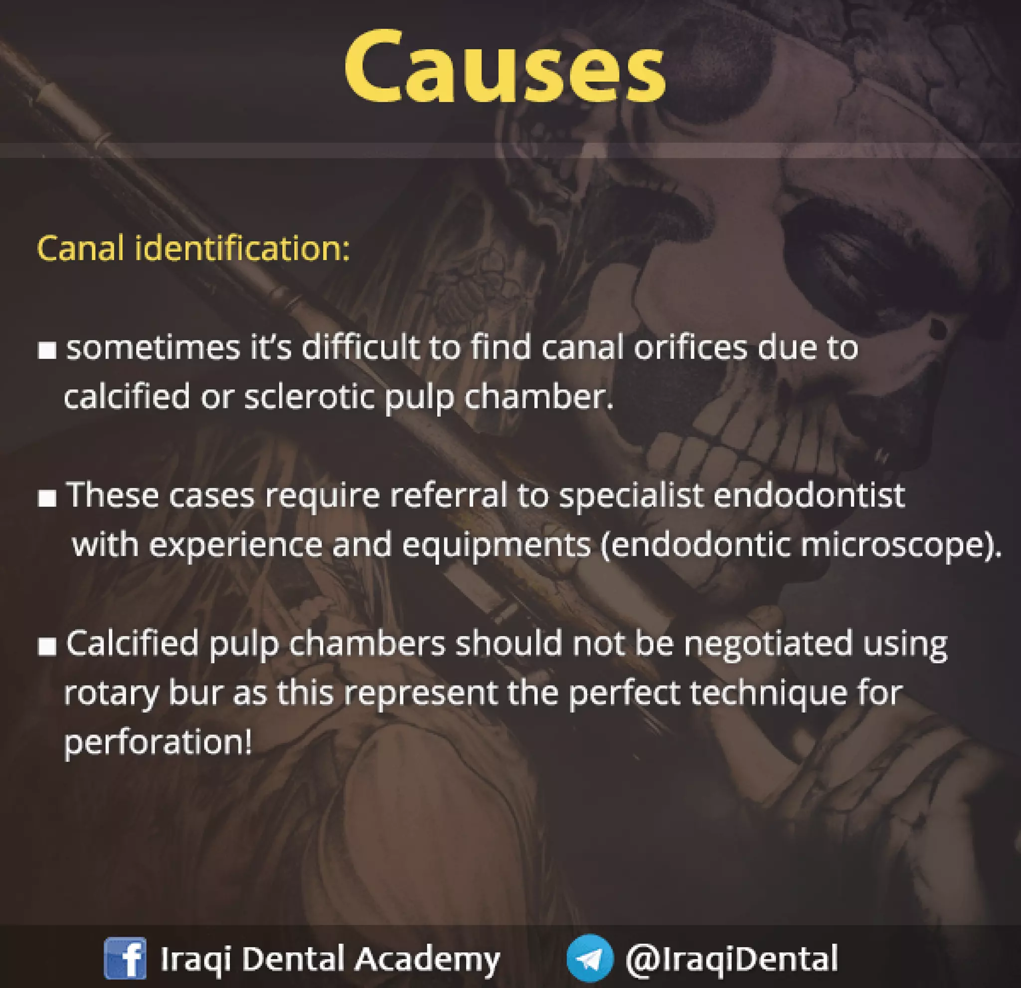 Endodontic Root Perforation: Causes, Identification, and Management Presentation