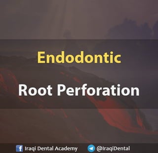 Endodontic Root Perforation: Causes, Identification, and Management Presentation