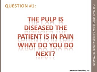 ENDODONTIC CAVITY PREPARATION