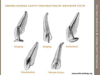 Terminologypulp space morphology & coronal cavity preparationCanal Types