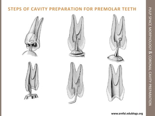 Principles of Coronal Cavity Preparationpulp space morphology & coronal cavity preparationOutline formSize of the pulp chamberShape of the pulp chamberNumber, position & curvatures of the root canals