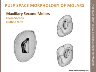 Principles of Coronal Cavity Preparationpulp space morphology & coronal cavity preparationToilet of the cavity:The rule isAs much as you canAs many times as you canWhy? 3 Reasons