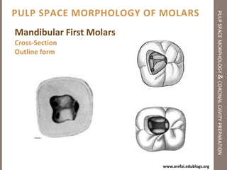 Principles of Coronal Cavity Preparationpulp space morphology & coronal cavity preparationYou will never get from point A to point B consistently without a map        Point A							 Point B