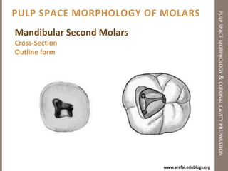 Pulp Space Morphology of Anterior Teethpulp space morphology & coronal cavity preparationUpper Lateral IncisorAverage Length: 22.5 mmRoot Number & Form: 1Canal Types: Type ICommon Curvatures: Distal, StraightLabio-Lingual sectionMesio-Distal sectionCross-SectionsOutline form
