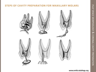 Pulp Space Morphology of Anterior Teethpulp space morphology & coronal cavity preparationLower Central & Lateral IncisorAverage Length: 21 mmRoot Number & Form: 1Canal Types: Type I	60%	           Type II	30%	           Type III	10%	Common Curvatures: Straight, DistalLabio-Lingual sectionMesio-Distal sectionCross-SectionsOutline form