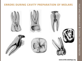 Steps of Cavity Preparation for Anterior Teethpulp space morphology & coronal cavity preparation