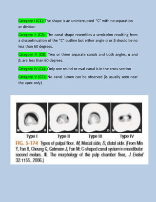 Category I (C1): The shape is an uninterrupted “C” with no separation
or division
Category II (C2): The canal shape resembles a semicolon resulting from
a discontinuation of the “C” outline but either angle α or β should be no
less than 60 degrees.
Category III (C3): Two or three separate canals and both angles, α and
β, are less than 60 degrees.
Category IV (C4): Only one round or oval canal is in the cross-section
Category V (C5): No canal lumen can be observed (is usually seen near
the apex only)
 