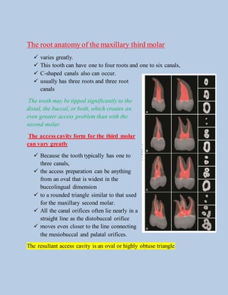 The root anatomy of the maxillary third molar
 varies greatly.
 This tooth can have one to four roots and one to six canals,
 C-shaped canals also can occur.
 usually has three roots and three root
canals
The tooth may be tipped significantly to the
distal, the buccal, or both, which creates an
even greater access problem than with the
second molar.
The access cavity form for the third molar
can vary greatly
 Because the tooth typically has one to
three canals,
 the access preparation can be anything
from an oval that is widest in the
buccolingual dimension
 to a rounded triangle similar to that used
for the maxillary second molar.
 All the canal orifices often lie nearly in a
straight line as the distobuccal orifice
 moves even closer to the line connecting
the mesiobuccal and palatal orifices.
The resultant access cavity is an oval or highly obtuse triangle
 