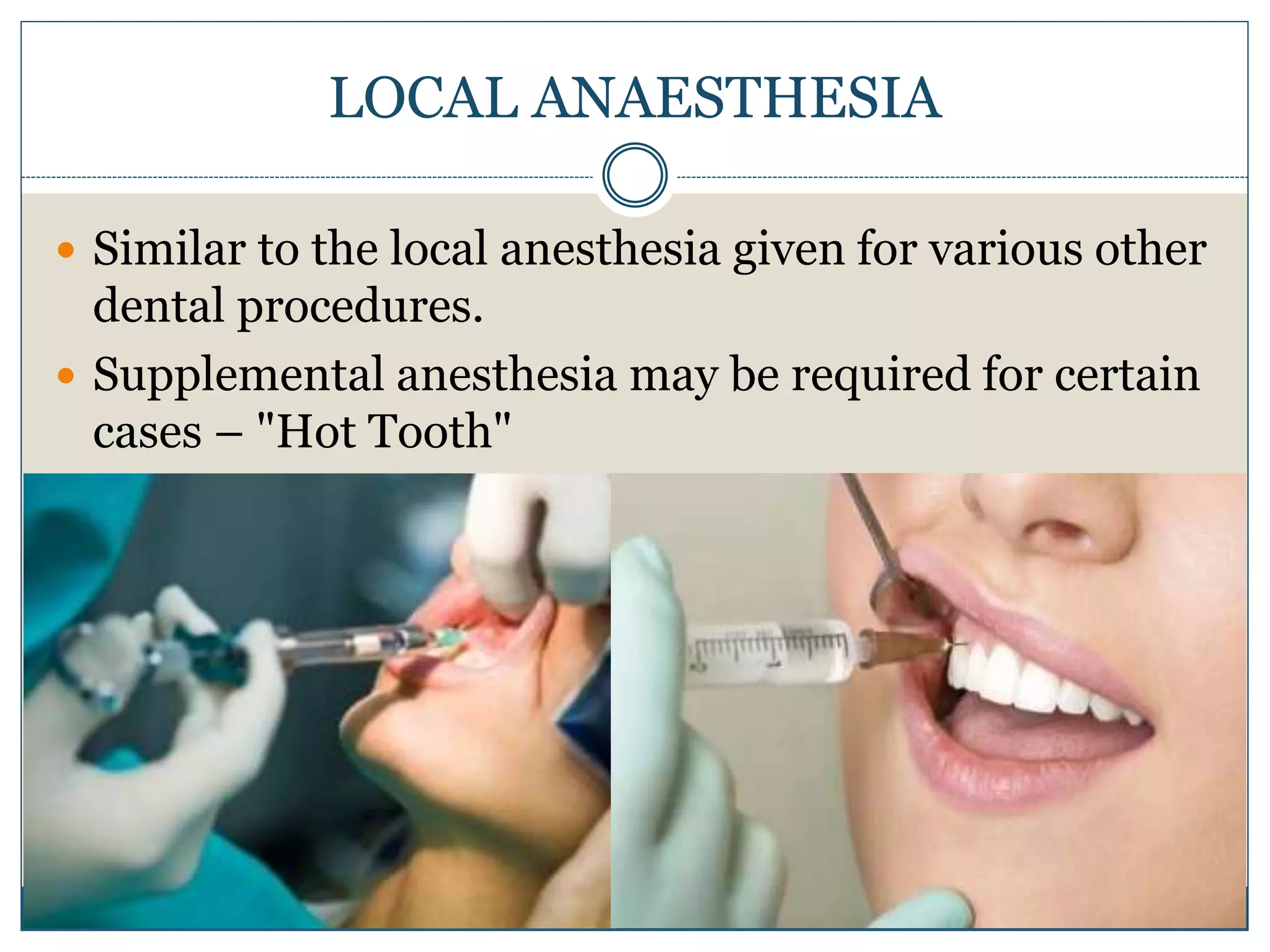 LOCAL ANAESTHESIA
 Similar to the local anesthesia given for various other
dental procedures.
 Supplemental anesthesia may be required for certain
cases – "Hot Tooth"
 