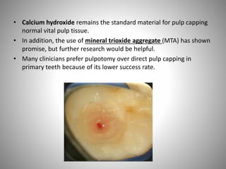 • Calcium hydroxide remains the standard material for pulp capping
normal vital pulp tissue.
• In addition, the use of mineral trioxide aggregate (MTA) has shown
promise, but further research would be helpful.
• Many clinicians prefer pulpotomy over direct pulp capping in
primary teeth because of its lower success rate.
 