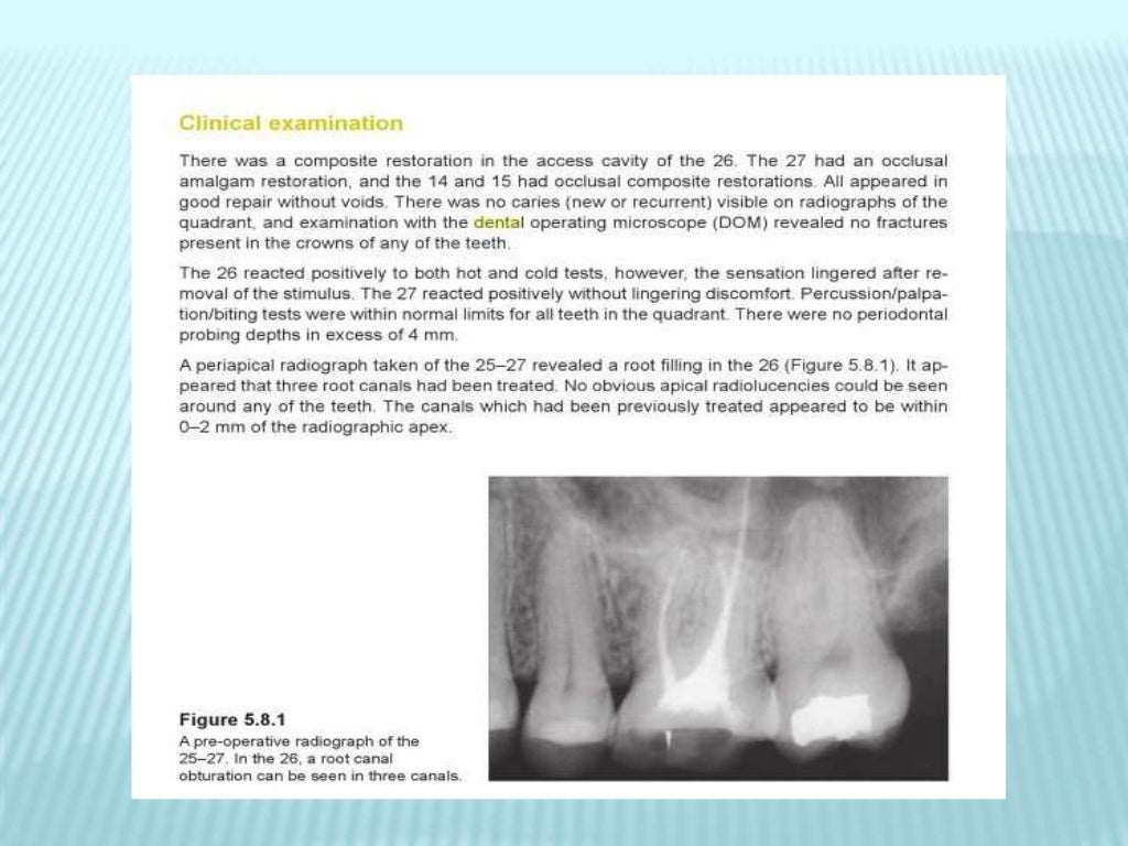Endodontics study cases