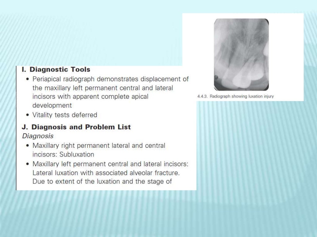 Endodontics study cases