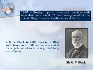 1880 – Brophy reported root-end resection with
immediate root canal fill and management of the
apical filling in a patient with extraoral fistula
Sir G. V. Black
 G. V. Black in 1886, Farrar in 1884
and Grayston in 1887 also recommended
for amputation of roots in neglected long
term abscess
 