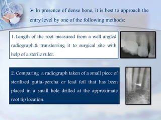  In presence of dense bone, it is best to approach the
entry level by one of the following methods:
1. Length of the root measured from a well angled
radiograph,& transferring it to surgical site with
help of a sterile ruler.
2. Comparing a radiograph taken of a small piece of
sterilized gutta-percha or lead foil that has been
placed in a small hole drilled at the approximate
root tip location.
 