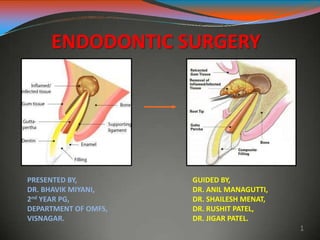 ENDODONTIC SURGERY
PRESENTED BY,
DR. BHAVIK MIYANI,
2nd YEAR PG,
DEPARTMENT OF OMFS,
VISNAGAR.
GUIDED BY,
DR. ANIL MANAGUTTI,
DR. SHAILESH MENAT,
DR. RUSHIT PATEL,
DR. JIGAR PATEL.
1
 