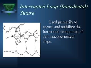 Interrupted Loop (Interdental)
Suture
Used primarily to
secure and stabilize the
horizontal component of
full mucoperiosteal
flaps.
 