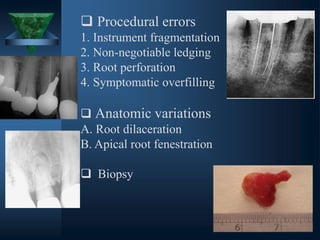  Procedural errors
1. Instrument fragmentation
2. Non-negotiable ledging
3. Root perforation
4. Symptomatic overfilling
 Anatomic variations
A. Root dilaceration
B. Apical root fenestration
 Biopsy
 