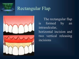 Rectangular Flap
The rectangular flap
is formed by an
intrasulcular,
horizontal incision and
two vertical releasing
incisions
 