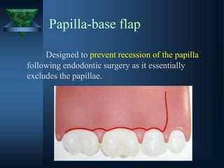 Papilla-base flap
Designed to prevent recession of the papilla
following endodontic surgery as it essentially
excludes the papillae.
 