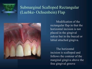 Submarginal Scalloped Rectangular
(Luebke- Ochsenbein) Flap
Modification of the
rectangular flap in that the
horizontal incision is not
placed in the gingival
sulcus but in the buccal or
labial attached gingiva.
The horizontal
incision is scalloped and
follows the contour of the
marginal gingiva above the
free gingival groove
 