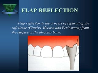 FLAP REFLECTION
Flap reflection is the process of separating the
soft tissue (Gingiva Mucosa and Periosteum) from
the surface of the alveolar bone.
 