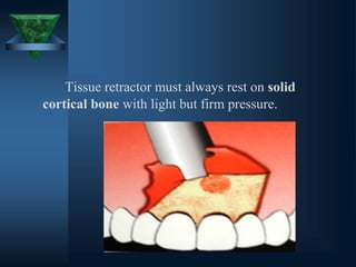 Tissue retractor must always rest on solid
cortical bone with light but firm pressure.
 