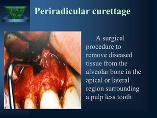 Periradicular curettage
A surgical
procedure to
remove diseased
tissue from the
alveolar bone in the
apical or lateral
region surrounding
a pulp less tooth
 