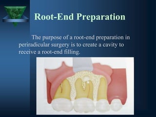 Root-End Preparation
The purpose of a root-end preparation in
periradicular surgery is to create a cavity to
receive a root-end filling.
 
