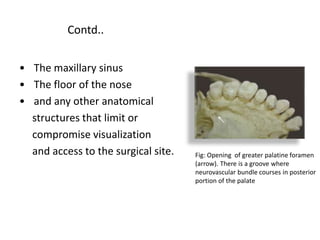 Contd..
• The maxillary sinus
• The floor of the nose
• and any other anatomical
structures that limit or
compromise visualization
and access to the surgical site. Fig: Opening of greater palatine foramen
(arrow). There is a groove where
neurovascular bundle courses in posterior
portion of the palate
 