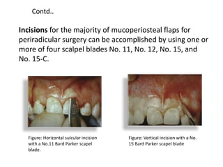 Incisions for the majority of mucoperiosteal flaps for
periradicular surgery can be accomplished by using one or
more of four scalpel blades No. 11, No. 12, No. 15, and
No. 15-C.
Figure: Horizontal sulcular incision
with a No.11 Bard Parker scapel
blade.
Figure: Vertical incision with a No.
15 Bard Parker scapel blade
Contd..
 