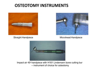 OSTEOTOMY INSTRUMENTS
Straight Handpiece Microhead Handpiece
Impact air 45o handpiece with H161 Lindemann bone cutting bur
– instrument of choice for osteotomy
 