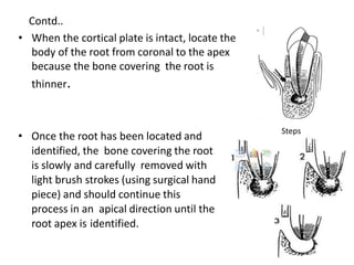 • Once the root has been located and
identified, the bone covering the root
is slowly and carefully removed with
light brush strokes (using surgical hand
piece) and should continue this
process in an apical direction until the
root apex is identified.
Contd..
• When the cortical plate is intact, locate the
body of the root from coronal to the apex
because the bone covering the root is
thinner.
Steps
 