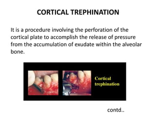 CORTICAL TREPHINATION
It is a procedure involving the perforation of the
cortical plate to accomplish the release of pressure
from the accumulation of exudate within the alveolar
bone.
contd..
 