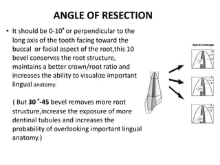 • It should be 0-10° or perpendicular to the
long axis of the tooth facing toward the
buccal or facial aspect of the root,this 10
bevel conserves the root structure,
maintains a better crown/root ratio and
increases the ability to visualize important
lingual anatomy.
( But 30 °-45 bevel removes more root
structure,increase the exposure of more
dentinal tubules and increases the
probability of overlooking important lingual
anatomy.)
ANGLE OF RESECTION
 