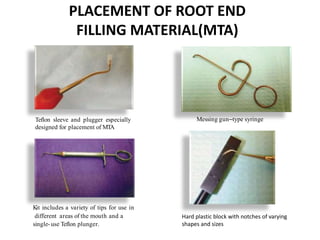 Teflon sleeve and plugger especially
designed for placement of MTA
Messing gun–type syringe
PLACEMENT OF ROOT END
FILLING MATERIAL(MTA)
Kit includes a variety of tips for use in
different areas of the mouth and a
single- use Teflon plunger.
Hard plastic block with notches of varying
shapes and sizes
 
