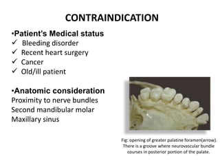 CONTRAINDICATION
•Patient’s Medical status
 Bleeding disorder
 Recent heart surgery
 Cancer
 Old/ill patient
•Anatomic consideration
Proximity to nerve bundles
Second mandibular molar
Maxillary sinus
Fig: opening of greater palatine foramen(arrow).
There is a groove where neurovascular bundle
courses in posterior portion of the palate.
 