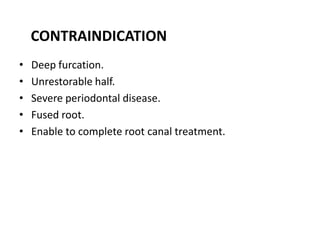 CONTRAINDICATION
• Deep furcation.
• Unrestorable half.
• Severe periodontal disease.
• Fused root.
• Enable to complete root canal treatment.
 