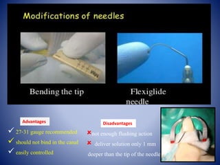  27-31 gauge recommended
 should not bind in the canal
 easily controlled
Advantages
not enough flushing action
 deliver solution only 1 mm
deeper than the tip of the needle
Disadvantages
 