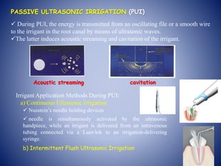 PASSIVE ULTRASONIC IRRIGATION (PUI)
 During PUI, the energy is transmitted from an oscillating file or a smooth wire
to the irrigant in the root canal by means of ultrasonic waves.
The latter induces acoustic streaming and cavitation of the irrigant.
Irrigant Application Methods During PUI:
a) Continuous Ultrasonic Irrigation
 Nusstein’s needle holding devices
 needle is simultaneously activated by the ultrasonic
handpiece, while an irrigant is delivered from an intravenous
tubing connected via a Luer-lok to an irrigation-delivering
syringe.
b) Intermittent Flush Ultrasonic Irrigation
Acoustic streaming cavitation
 