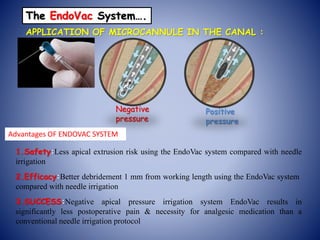 The EndoVac System….
APPLICATION OF MICROCANNULE IN THE CANAL :
Negative
pressure
Positive
pressure
Advantages OF ENDOVAC SYSTEM
1.Safety:Less apical extrusion risk using the EndoVac system compared with needle
irrigation
2.Efficacy:Better debridement 1 mm from working length using the EndoVac system
compared with needle irrigation
3.SUCCESS:Negative apical pressure irrigation system EndoVac results in
significantly less postoperative pain & necessity for analgesic medication than a
conventional needle irrigation protocol
 
