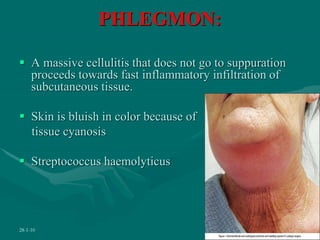 PHLEGMON:
 A massive cellulitis that does not go to suppuration
proceeds towards fast inflammatory infiltration of
subcutaneous tissue.
 Skin is bluish in color because of
tissue cyanosis
 Streptococcus haemolyticus
28-1-10 27
 