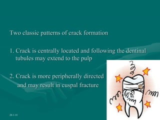 Two classic patterns of crack formation
1. Crack is centrally located and following the dentinal
tubules may extend to the pulp
2. Crack is more peripherally directed
and may result in cuspal fracture
28-1-10 34
 