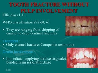 TOOTH FRACTURE WITHOUT
PULP INVOLVEMENT
28-1-10 45
Ellis class I, II,
WHO classification 873.60, 61
 They are ranging from chipping of
enamel to deep dentinal fractures
Treatment :
 Only enamel fracture: Composite restoration
Dentin involvement :
 Immediate : applying hard setting calcium hydroxide
bonded resin restoration.base
 