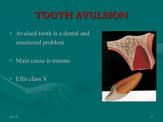 TOOTH AVULSION
• Avulsed tooth is a dental and
emotional problem
• Main cause is trauma
• Ellis class V
28-1-10 47
 