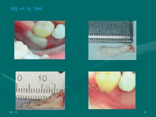 28-1-10 81
IEJ, vol 41, 2008
 