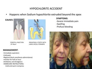 endo emergencies.pptx