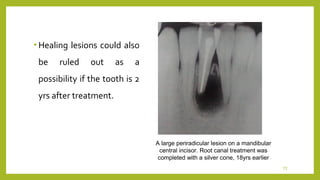 Endo failure | PPT